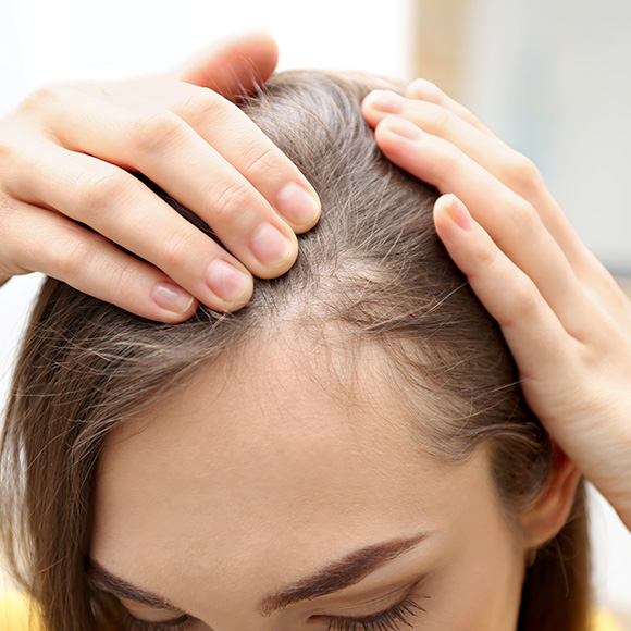 woman examining hair for thinning with both hands scalp health care for three main types of hair loss